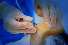 Artery (vein) catheterization in operation room. Image with shallow DOF.